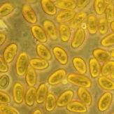 Sporen des Echten Hausschwammes (Serpula lacrymans) im mikroskopischen Bild