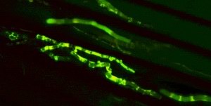 Vitalit�tspr�fung: Lebende Hyphen im Lumen der Holz-Zellen